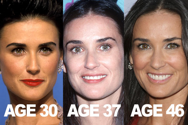 demi-moore-botox-before-and-after