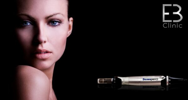Dermapen facial