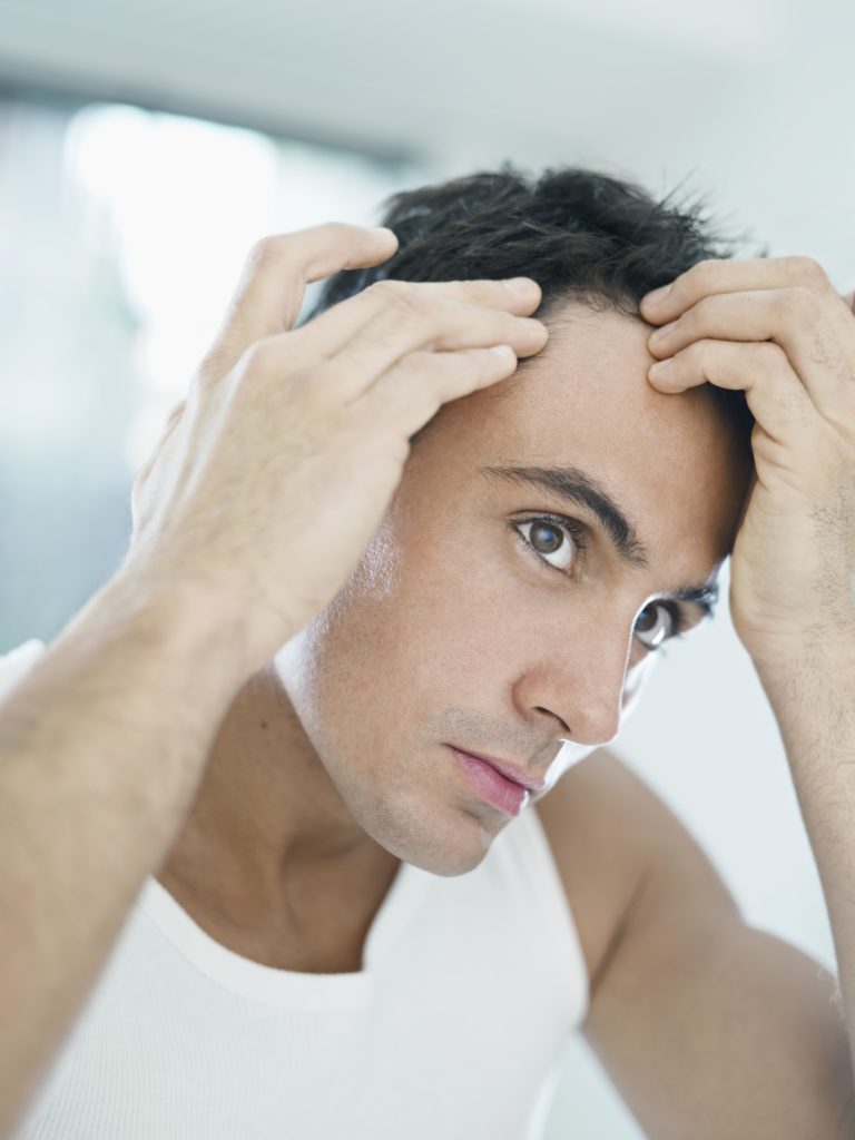 tratamientos para la caída del cabello en hombres