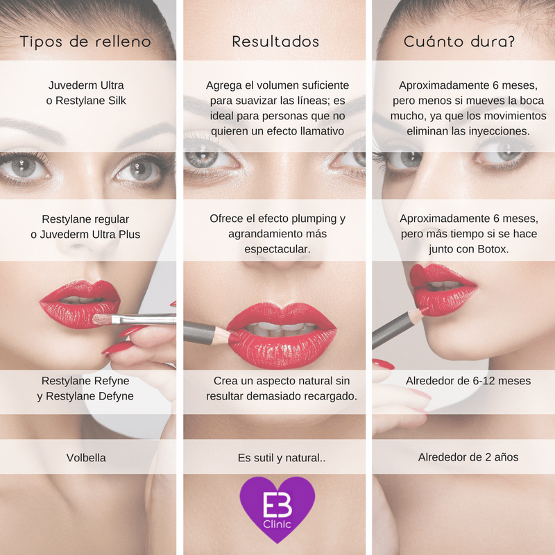 Tipos de relleno para labios