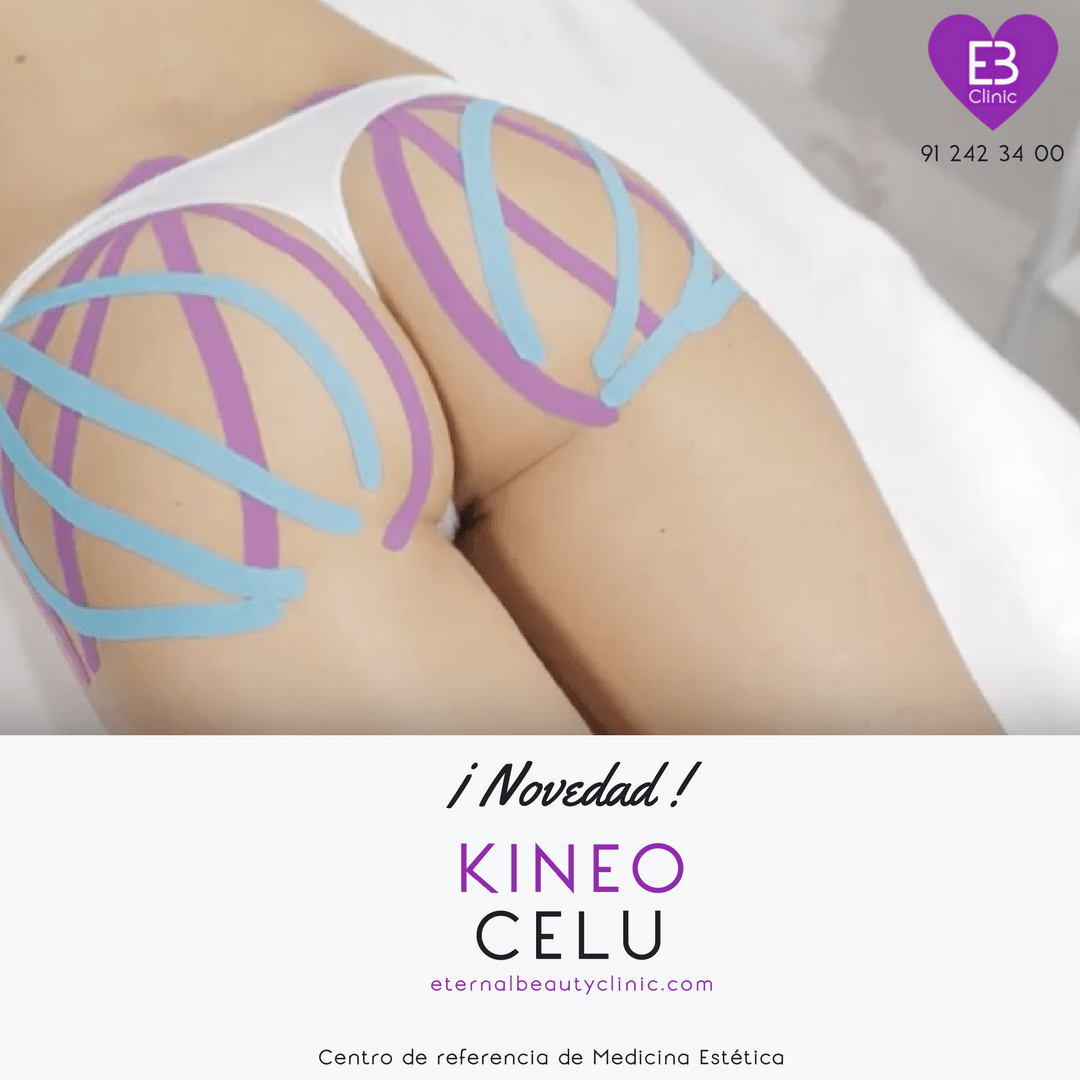 KineoCelu by Eternal Beauty Clinic