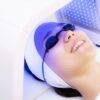 fototerapia facial