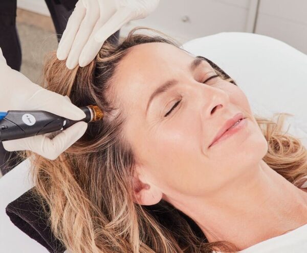 hydrafacial capilar