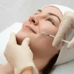 Plasma en la cara (bioestimulación facial): qué es, beneficios y resultados