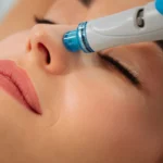 Hydrafacial en Madrid: qué es, para quién es y precio