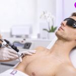 Depilación láser para hombres con Alejandrita de Cynosure