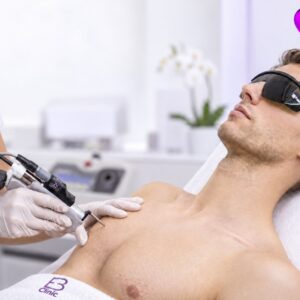 Depilación láser para hombres con Alejandrita de Cynosure