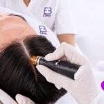 Hydrafacial capilar en Eternal Beauty Clinic Madrid