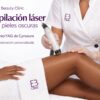Depilación láser para pieles oscuras con Neodimio:YAG de Cynosure - Eternal Beauty Clinic Príncipe de Vergara