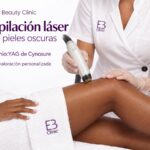 Depilación láser para pieles oscuras con Neodimio:YAG de Cynosure - Eternal Beauty Clinic Príncipe de Vergara