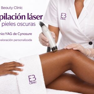 Depilación láser para pieles oscuras con Neodimio:YAG de Cynosure - Eternal Beauty Clinic Príncipe de Vergara