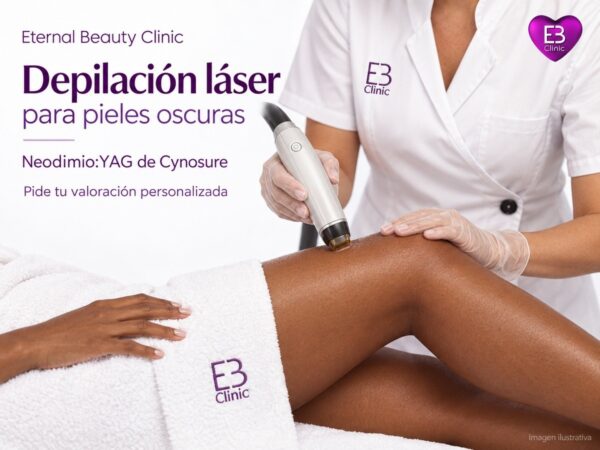 Depilación láser para pieles oscuras con Neodimio:YAG de Cynosure - Eternal Beauty Clinic Príncipe de Vergara