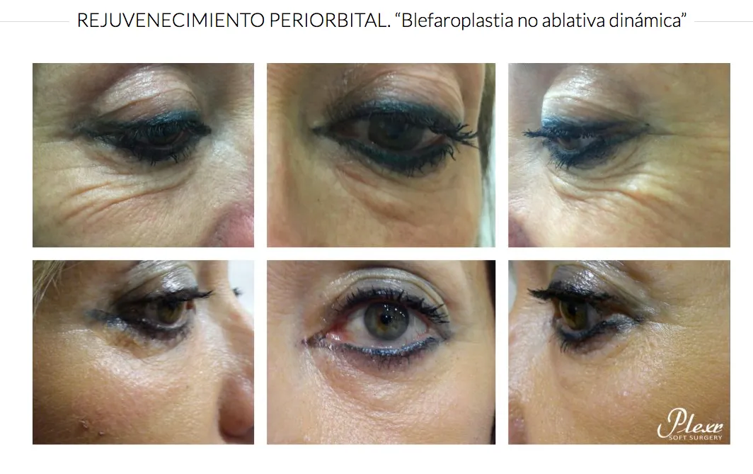Captura de pantalla 2017 09 04 a las 1 01 12 – Eternal Beauty Clinic Madrid