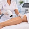 Escena ilustrativa: preparación de una sesión de depilación láser alejandrita en Eternal Beauty Clinic