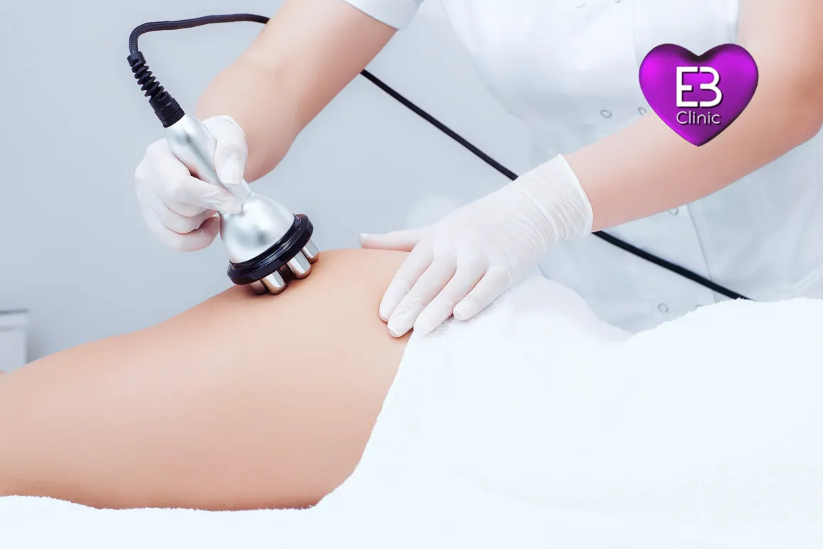 Radiofrecuencia Indiba en Eternal Beauty Clinic Madrid