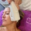 Sesión de HIFU facial sobre el pómulo en Eternal Beauty Clinic, Madrid