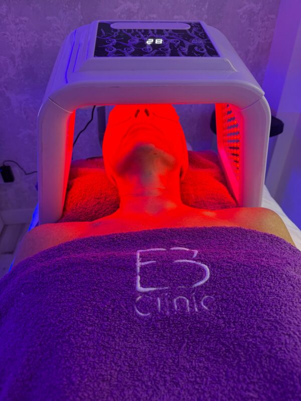 Sesión de fototerapia LED facial en Eternal Beauty Clinic, Madrid