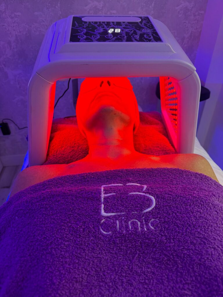 Sesión de fototerapia LED facial en Eternal Beauty Clinic, Madrid