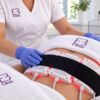 Escena ilustrativa: sesión de lipoláser no invasivo con placas de diodo en Eternal Beauty Clinic